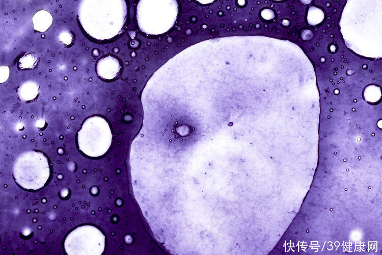 损伤|全球首创！中国专家用高温“烫”死癌细胞，治疗多种肿瘤，损伤小