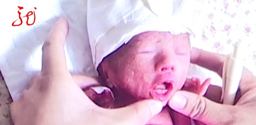 绥棱县|龙凤胎早产，哥哥不足3斤，妹妹890克！孩子父亲落泪：“砸锅卖铁也要救”！