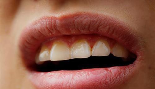 会让人出现|为什么睡到半夜,总感觉嘴里很干,还泛苦是身体哪出了问题