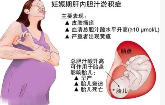 肚子|21岁怀孕八月肚子发痒,经医生检查后,她的脸却突然大变