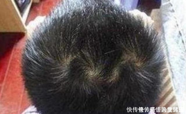 孩子头上的“旋”的个数，暗示孩子智商高低家长要了解真相