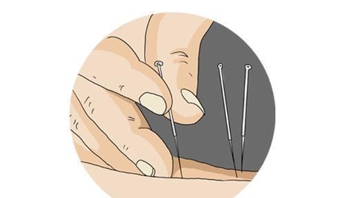 中医|治疗癌症，并不只有手术和化疗，中医也能应对癌症，抵抗肿瘤