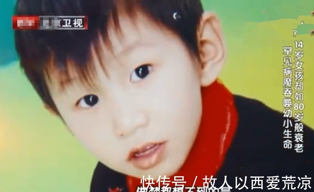 医生|14岁女孩像80岁老人,做完手术的1句话,让医生父母纷纷落泪