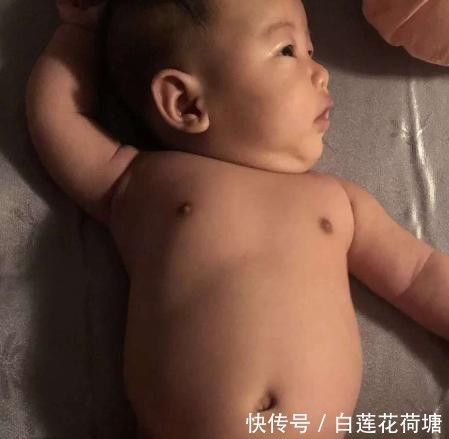 赶快|孩子有积食,发育会“慢半拍”,医生坦言:别吃药,赶快食疗