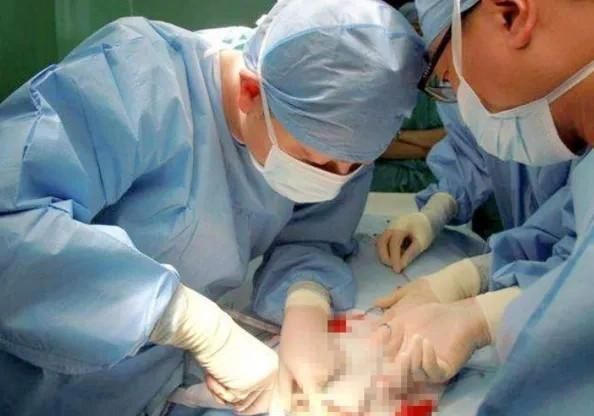 原来人体的这些器官是“多余”的,特别是第3个,被称为医生招财器官!