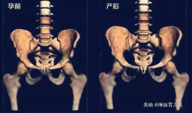 肚子|孕妈的肚子怎么可以那么大看看内脏被挤成啥样,女人当妈不容易