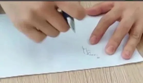 中老年人|女孩书写痉挛11年，写字、拿筷握鼠标，姿势怪异