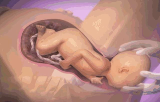 不好意思|顺产生娃最尴尬的就是“拉粑粑”,知晓原因才不慌,别不好意思看