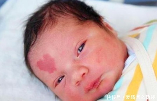 化妆品|胎记来源于孕期习惯？准妈妈们这3种恶习，会导致胎儿被胎记缠身