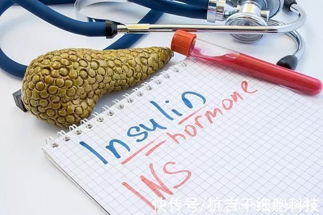 胰岛素|干细胞疗法在1型糖尿病中的作用机制及临床效果观察