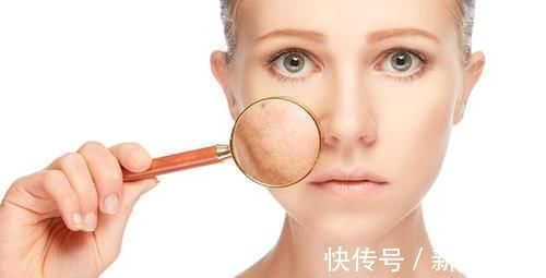 角质层|不会吧不会吧,好多人还不知道自己是敏感肌?怪不得皮肤越来越糟