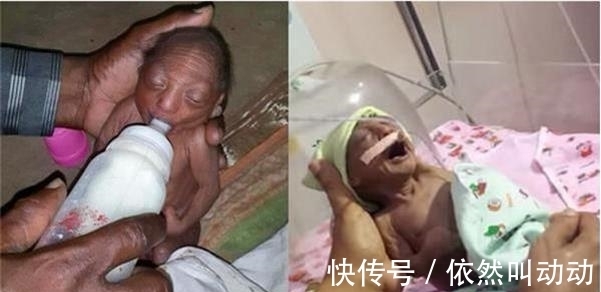 褶皱|母亲生下宝宝,奇丑无比狠心抛弃,爷爷喂奶抚养长大创造奇迹!