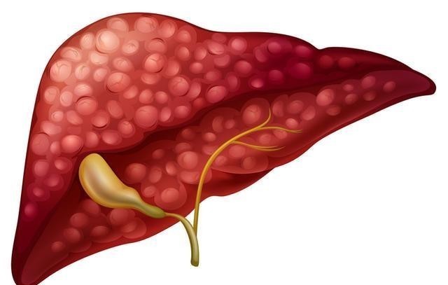 谨记|枸杞养生价值高,谨记“3常喝、3不碰”,或能为健康保驾护航