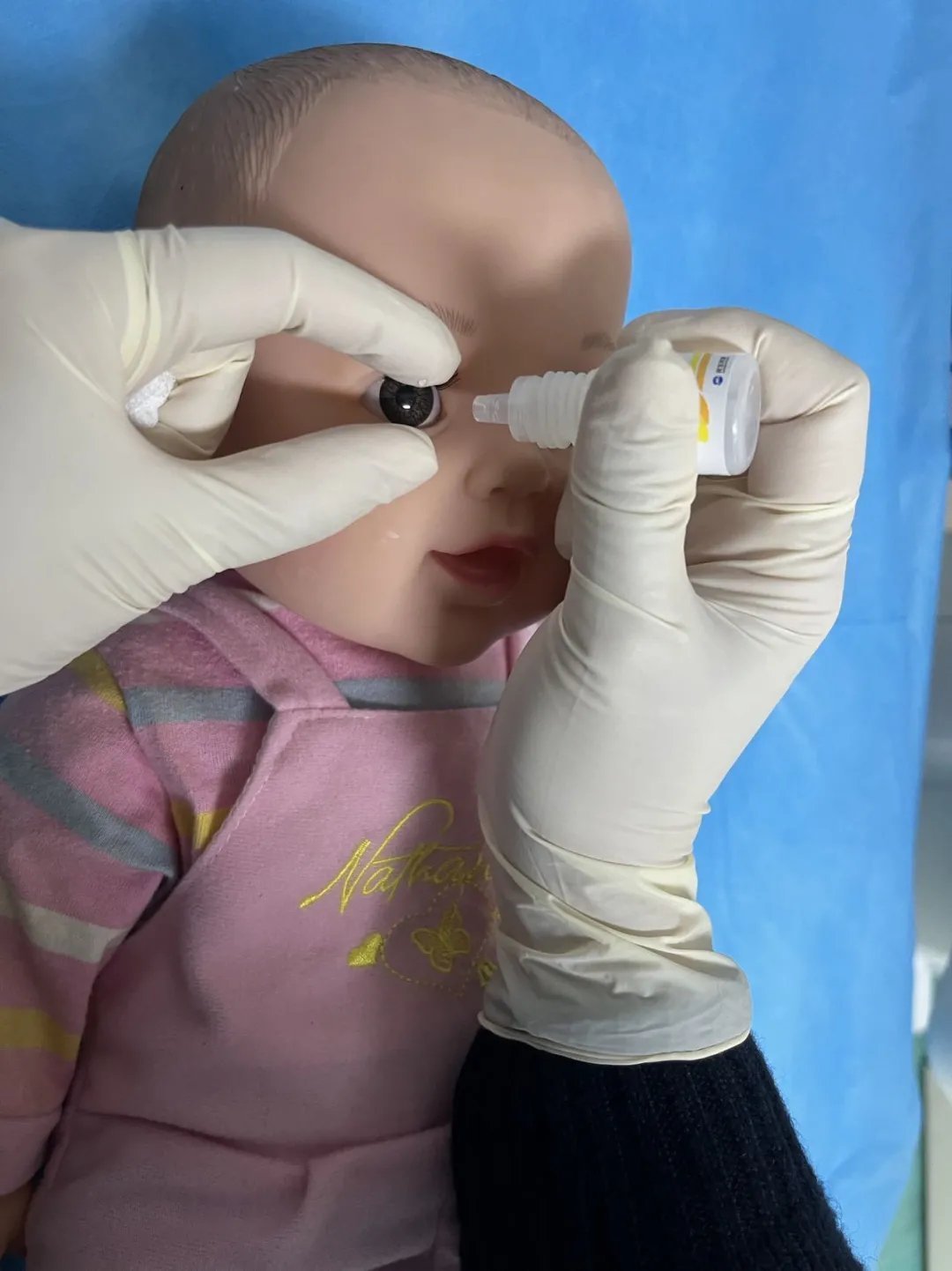 泪道|眼角抽出5管脓液,宝宝眼睛经常“泪汪汪”居然是病!拖延治疗严重的可能失明