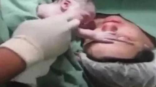 产妇难产心跳停止，婴儿伸手摸妈妈的脸，之后的画面让医生不淡定