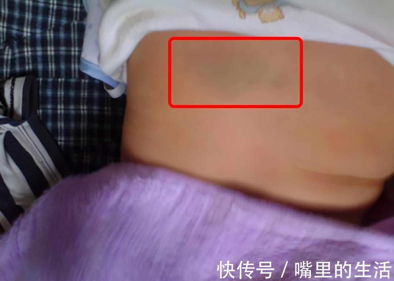 排出体外|新生儿出现这9个问题,很容易吓到妈妈,其实都是正常现象