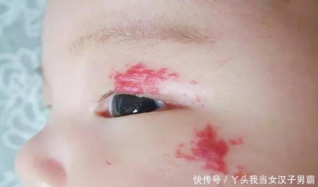 这三种行为会导致娃出生后有“胎记,”不想宝宝有,孕妈最好别做!