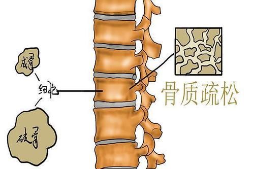 50岁左右的人，总感到浑身上下疼，是什么原因？该怎么办？