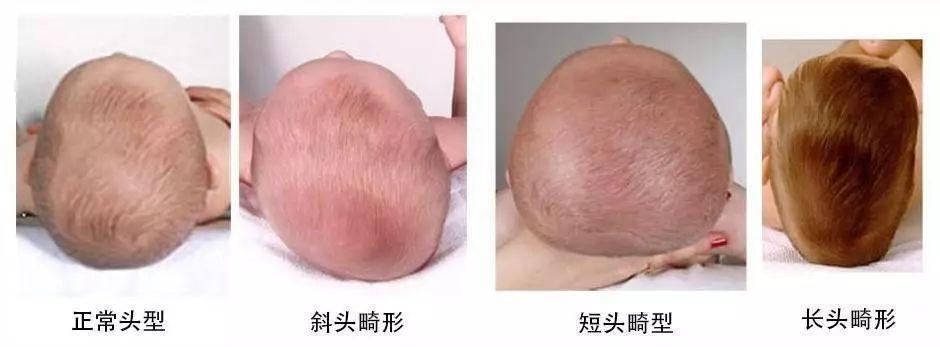 后脑|清朝人带来的陋习,至今都在影响着现代的孩子