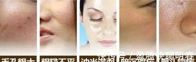 薇娅|能让李佳琦和薇娅看得上,这韩国去角质凝胶,实力真的很强大