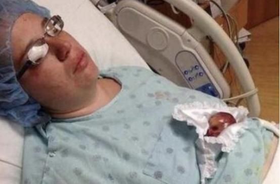 早产儿|曾经的最小婴儿用蛋壳当摇篮,现在13年过去了,她怎么样了