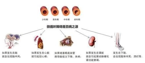 微循环|糖尿病有救了！疏通微循环恢复自愈力，有望逆转并发症