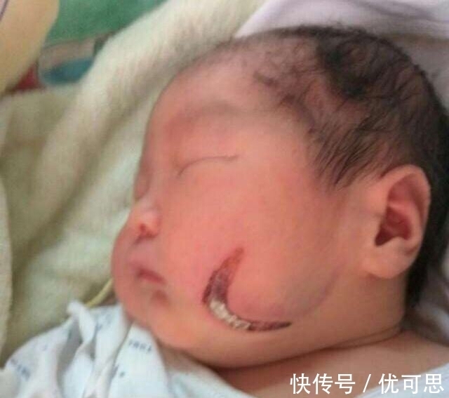 产科医生|女子发现宝宝脸有镰刀痕,去医院医生告知不是病,看完监控报了警