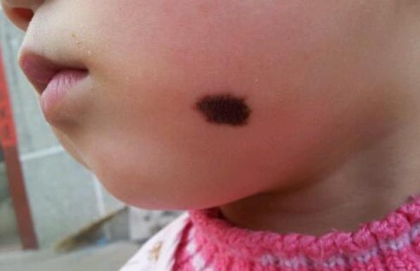 化学物质|胎儿自带“记号”,与孕妈错误行为有关,孕妈的放纵终由孩子买单