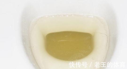 丈夫|夫妻变老后，为何大多是丈夫先去世？医生说出原因，男女都要重视