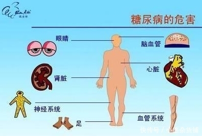  糖尿病|有糖尿病的人，几种食物常吃，血糖慢慢降下来