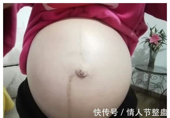 妊娠纹|怀孕后,肚子长毛还有黑色直线,怎么回事儿?