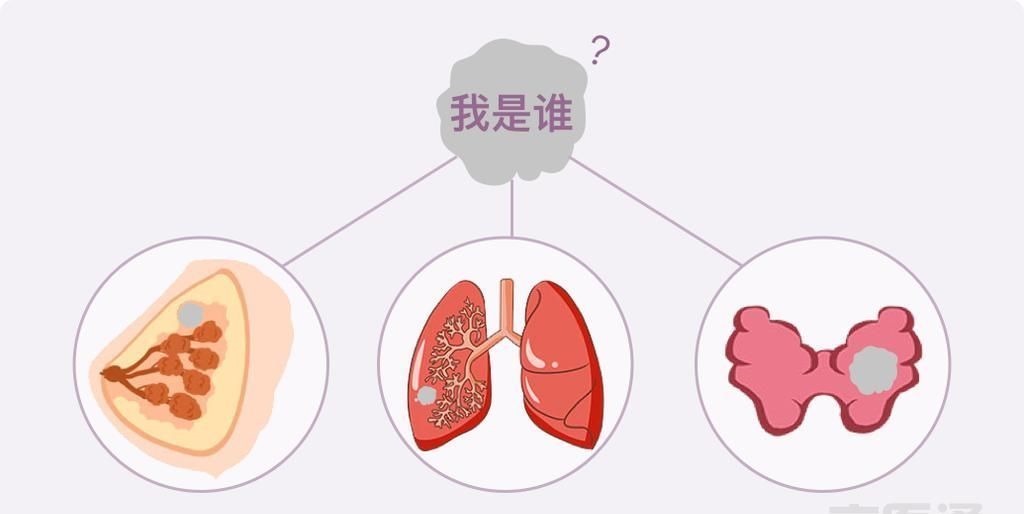 卵巢囊肿|结节、息肉、囊肿是癌症先兆吗?北肿专家们说出了真相!