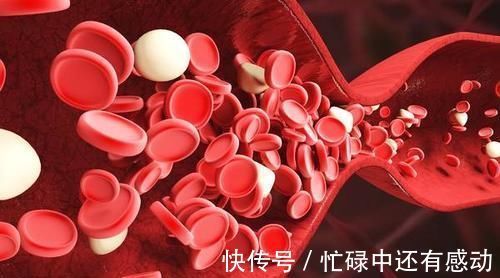 降血脂|血脂高不高，看脚就知道，四个方法让你血管畅通