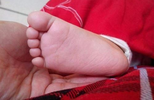 回家|宝妈下班回家,发现女儿的脚“胖了”,帮孩子脱掉袜子后笑出声