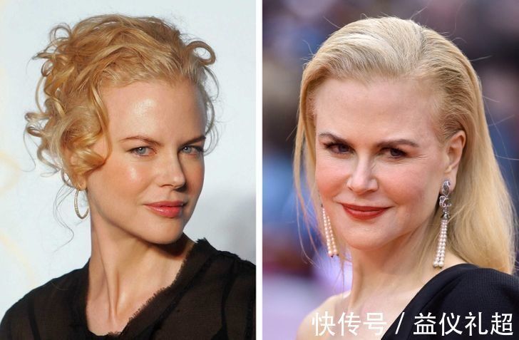 真实年龄|9个“直接戳破真实年龄”的衰老迹象,化妆也遮不住