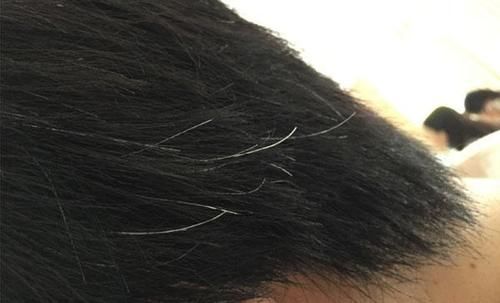 尿频尿急|男人老没老,身上的表现骗不了人,占3个以上,该服老了