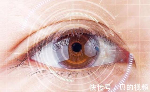 杀手|青少年防控近视，十大“视力杀手”排行必知