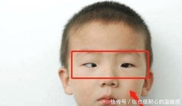 电子产品|越来越多孩子黑眼珠“消失”，与这种“玩具”脱不了干系，需警惕