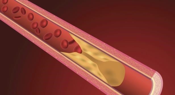 活血化瘀|丹参是一种血管清道夫,坚持吃的人不容易有血栓,但三类人不适合