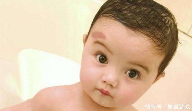 宝宝|宝宝为什么会长胎记?与孕期行为有关,孕妈怀孕后要克制自己
