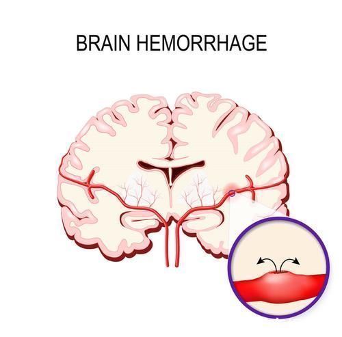 降压药|60岁的人血压多少算正常？心血管医生告诉你