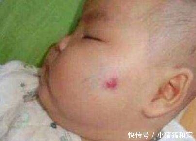 化妆品|怀孕期间,经常做这两件事的孕妈,胎儿容易长胎记,后悔都来不及