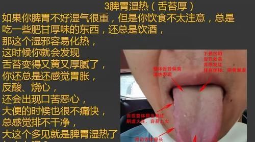 齿痕|齿痕重是脾虚，舌苔厚也是脾虚吗？怎样把舌苔变薄、齿痕消失呢？