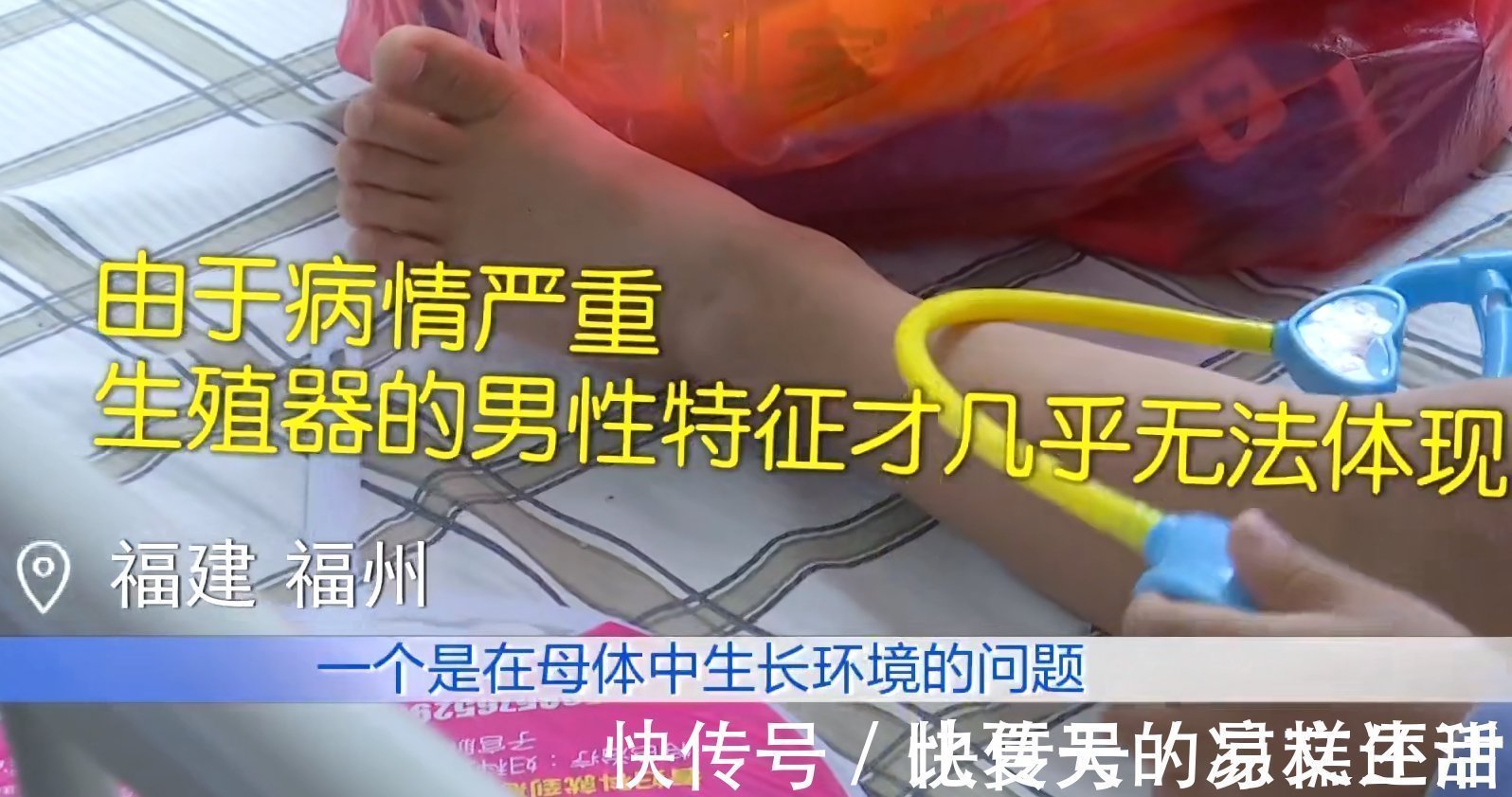 残疾人|女童被养到三岁大,到医院一查是个“纯爷们”,医生也是头一次见