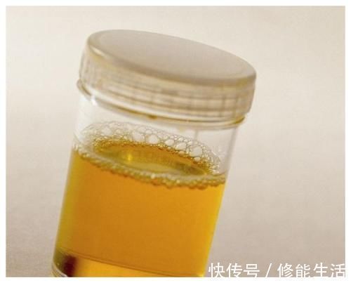 糖尿病患者|糖尿病患者,若有这3个表现,尽快查下血糖,留心并发症