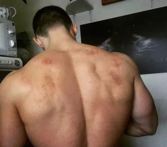 动作|5个血淋淋的案例告诉你,错误的健身动作会造成多大的伤害