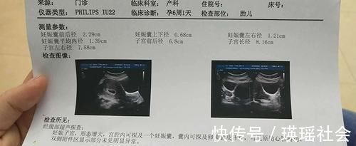 孕妈|怀孕后,胎心、胎芽多久才会出现?出现时间早晚受这三个原因影响