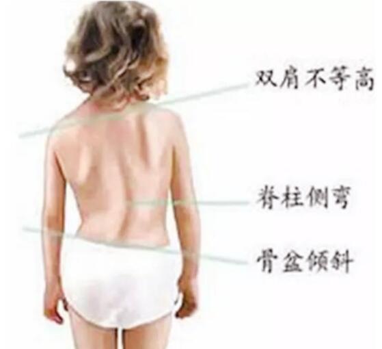 图解|家长这样抱孩子,当心娃以后驼背、高低肩,图解4种正确抱娃姿势