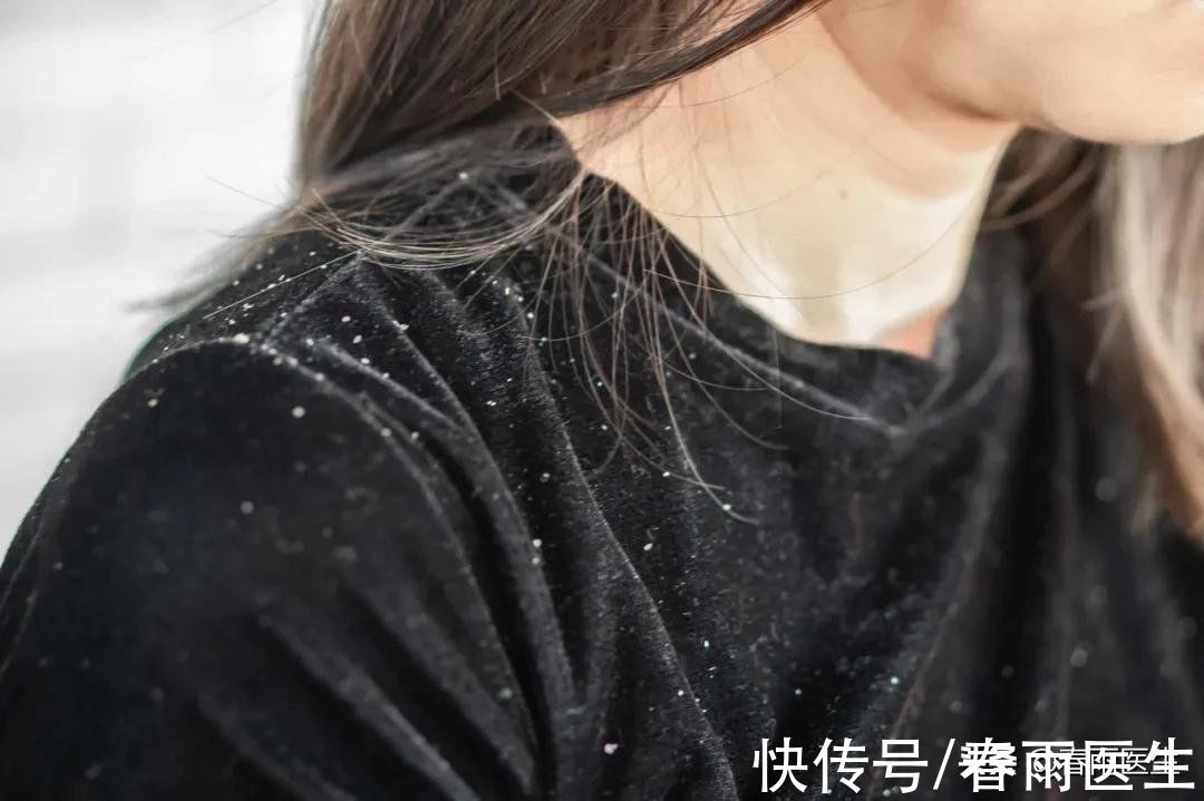 头皮糠疹|你发如雪......是病啊，得尽快治