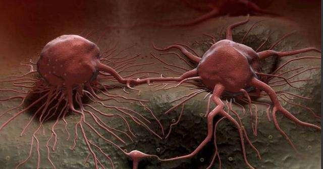 长寿|癌细胞“最怕”5件事!到了45岁,若能坚持做到,长寿或与你有缘